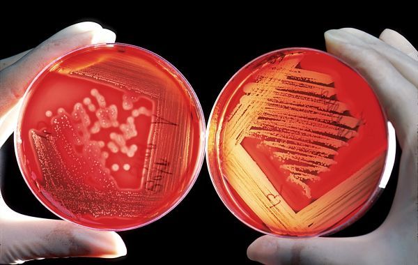 agar_breeding_ground_red_blood_cells_experiment_research_agar_agar_agartang-1142460.jpeg