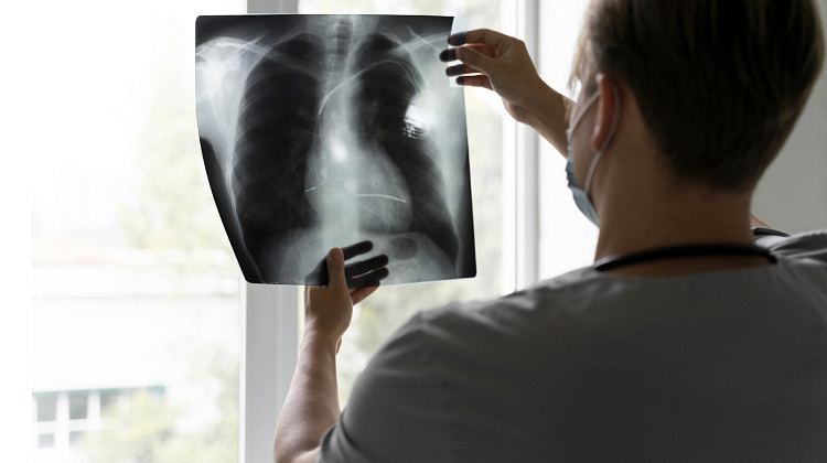 ��� ������� ������ ����� �����������: ���������� ������ ����������� ����� ����������